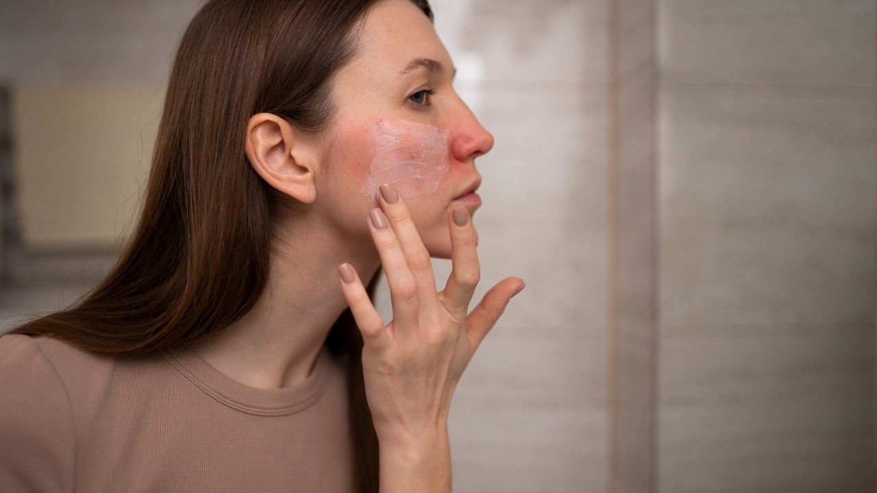 Benzoyl Peroxide