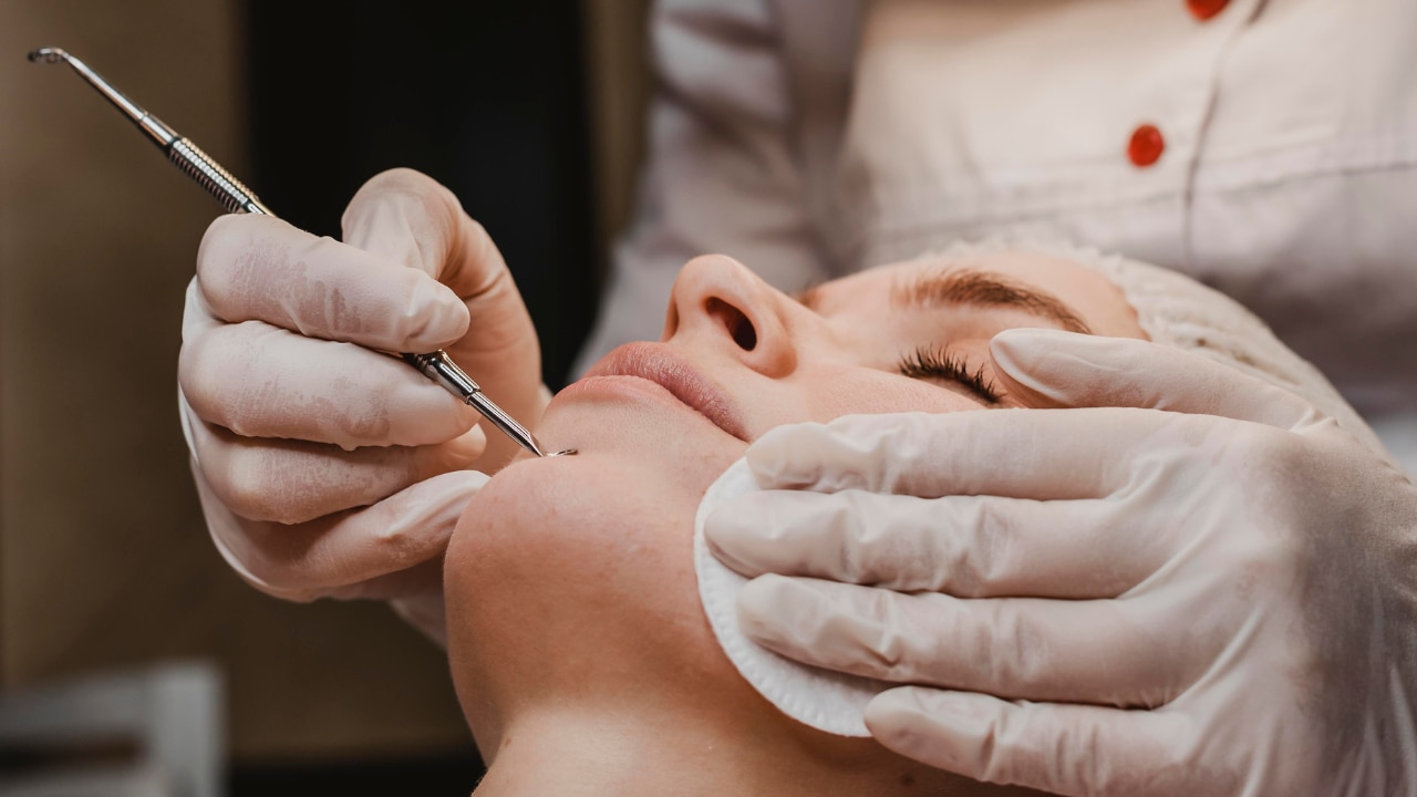 Comedone Extraction