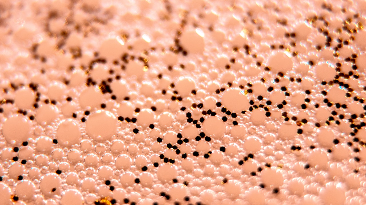 High Concentration of Sebaceous Glands