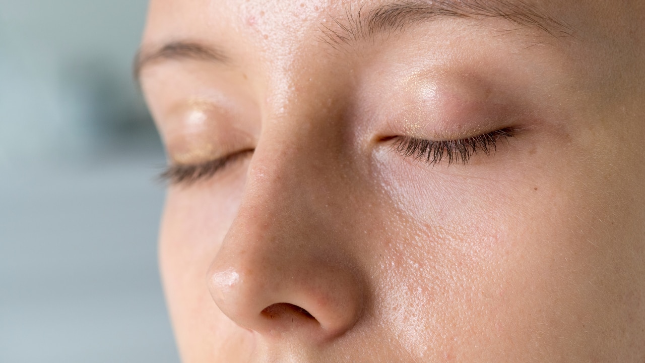 Oily skin