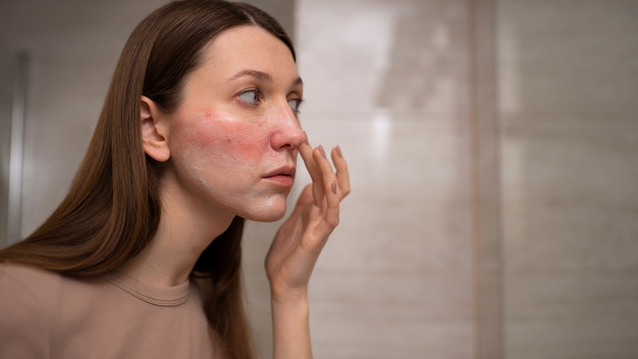 Skin Irritation Or Redness