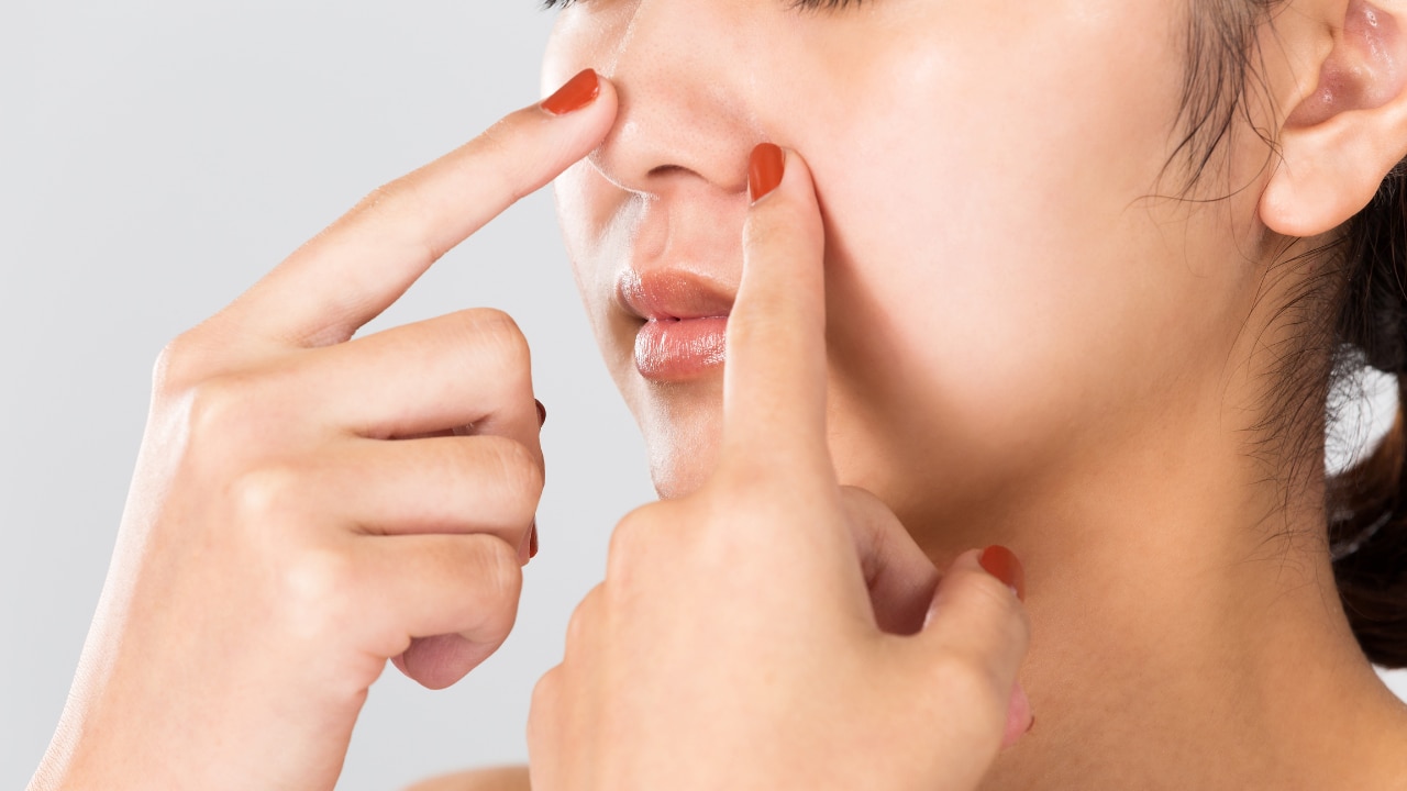 What Are Blackheads on Nose