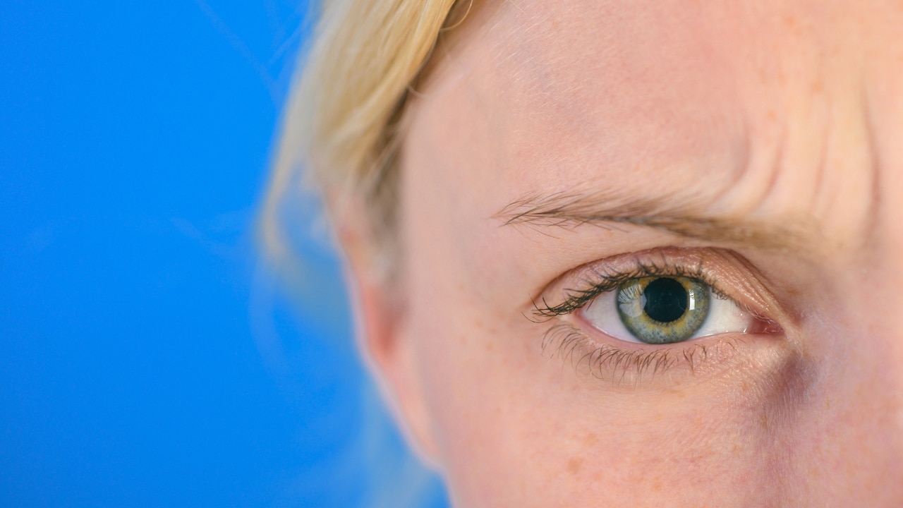 Why Are My Eyebrows Thinning?