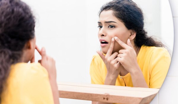 5 चीज़ें जो आपको पिम्पल्स के साथ नहीं करनी चाहिए