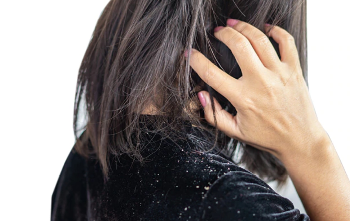 hot oil treatment for hair woman brunette hot oil treatment for hair woman brunette