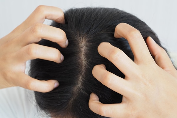 FAQs on jojoba oil for hair