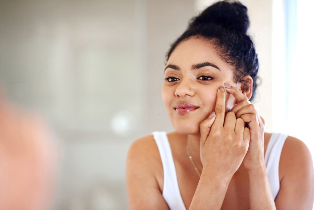 FAQs on acne scars