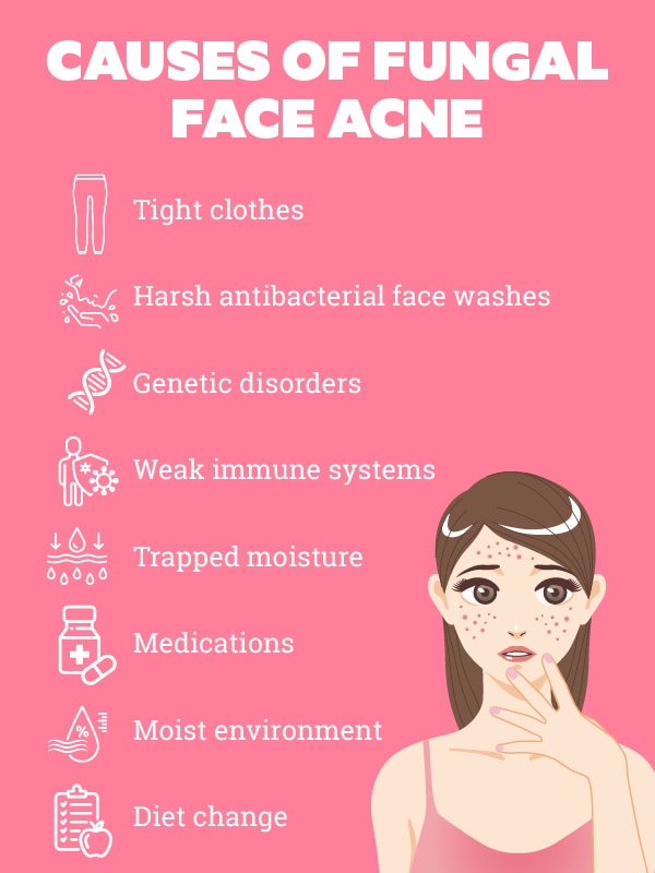 How to treat fungal face acne?