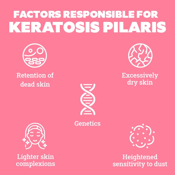 FAQs about keratosis pilaris 