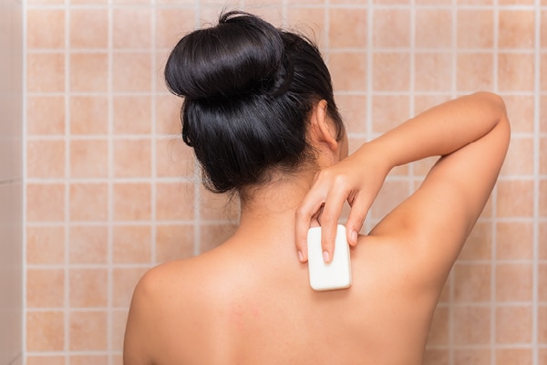 FAQs about keratosis pilaris 