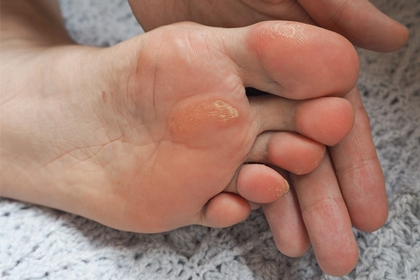 Icy foot soak