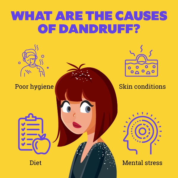 FAQs about ayurvedic treatments for dandruff