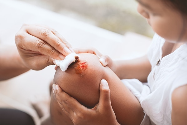 FAQs about tea tree oil uses for skin and hair FAQs about tea tree oil uses for skin and hair