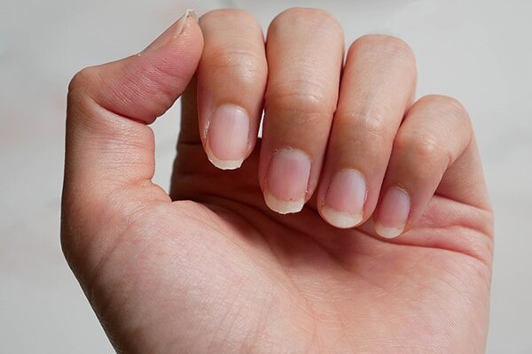 Solves nail problems Solves nail problems