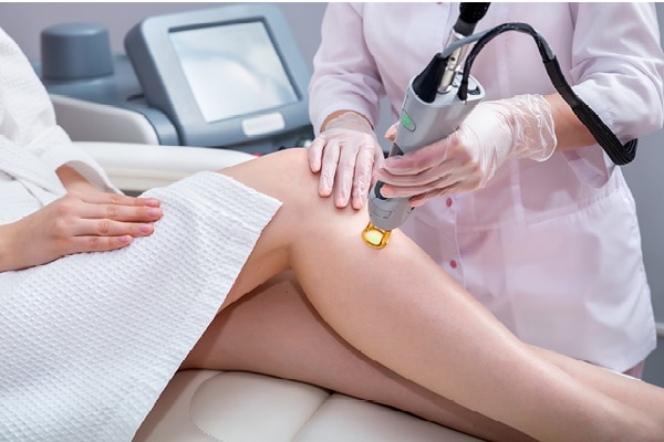 FAQs about electrolysis hair removal