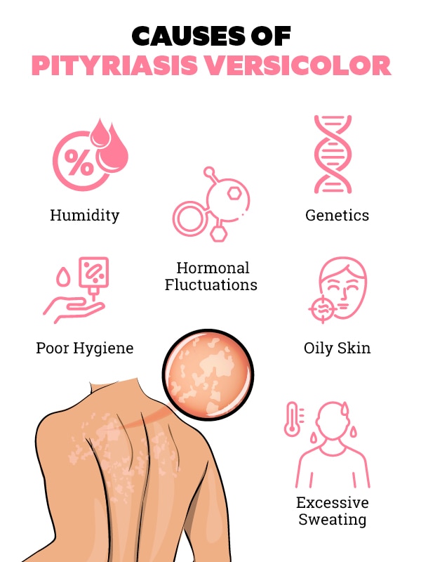 Preventing Pityriasis Versicolor