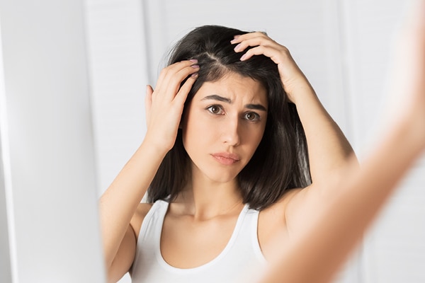 BB: Any home remedies that can help keep dandruff at bay this winter?