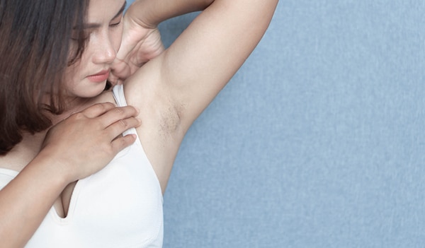 How to lighten and prevent underarm darkness