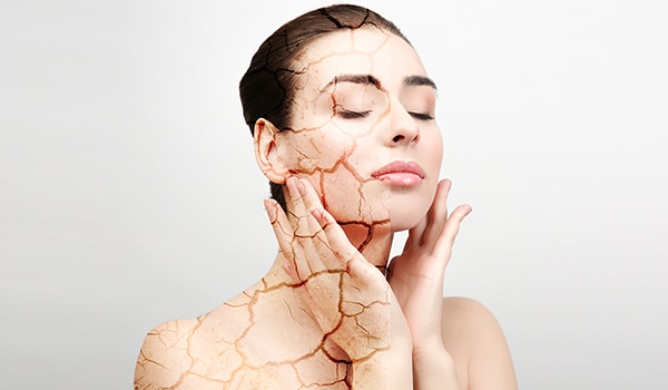 5 ways to care for dry skin during monsoon