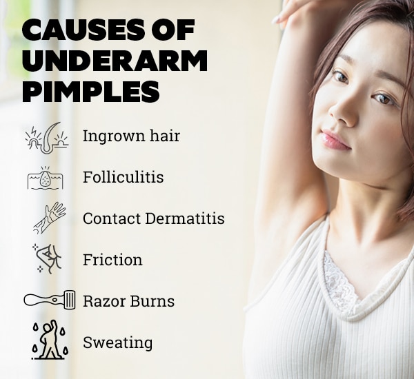 Got Pimples in Your Armpit? Here's Everything You Need To Know