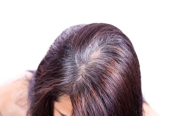 Frequently asked questions about benefits of shikakai for hair