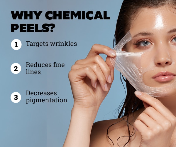 FAQs on chemical peels at home: