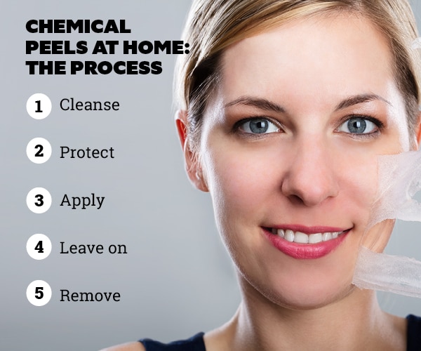 FAQs on chemical peels at home: