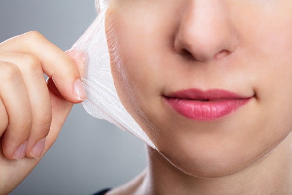 FAQs on chemical peels at home: