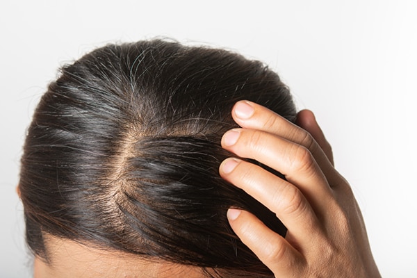 Are fenugreek seeds the answer to all your hair woes?