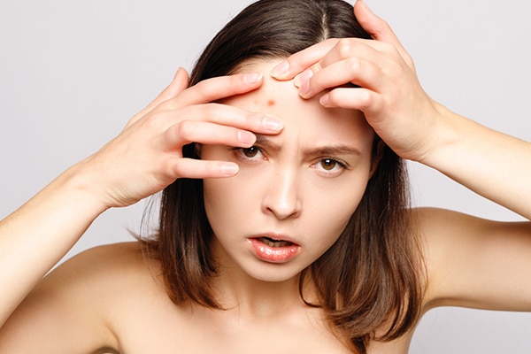 dry skin dry skin