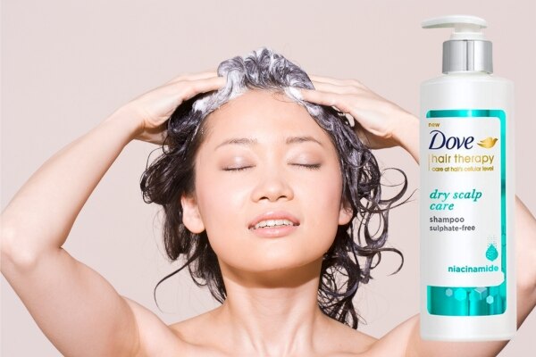 dry-scalp-in-winter dry-scalp-in-winter