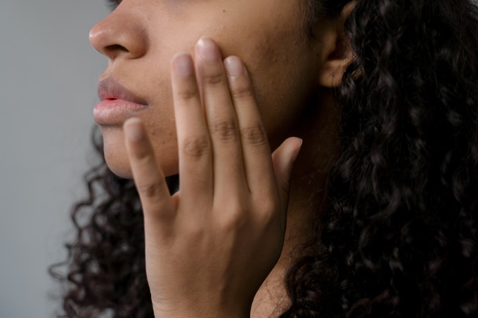 FAQs about Clear Skin Trends and Tips FAQs about Clear Skin Trends and Tips