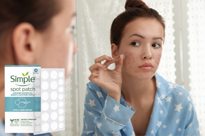 FAQs about Acne Prone Skin