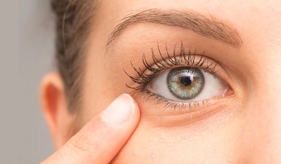 FAQs on eye puffiness