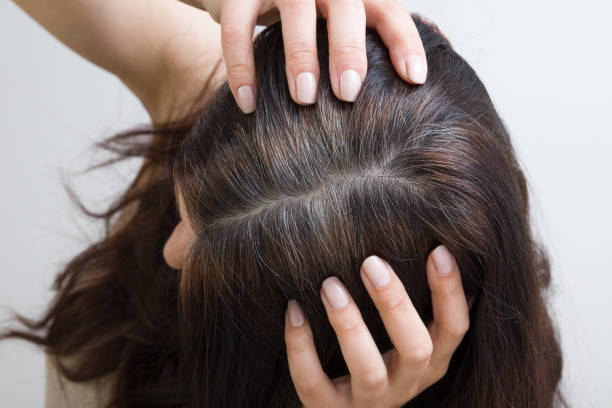 FAQs about tips for itchy scalp