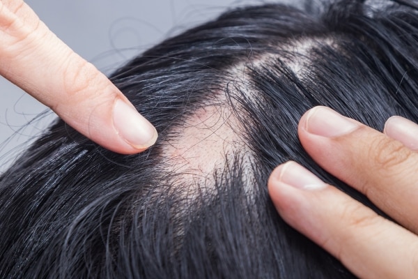 Hair Growth Oil Myths Debunked Hair Growth Oil Myths Debunked