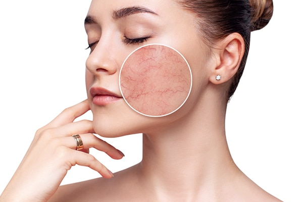 FAQs about sensitive skin