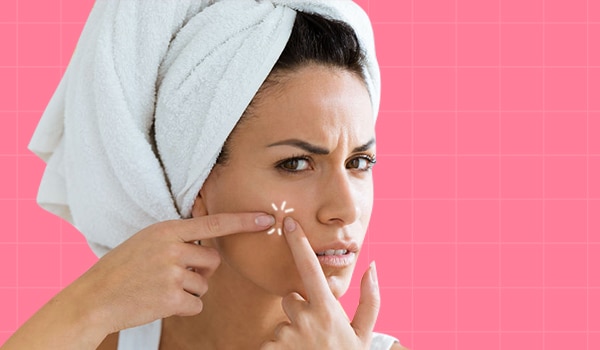 How to get rid of acne: expert recommended tips and solutions