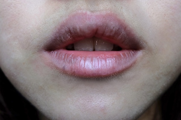FAQs related to lighten dark lips FAQs related to lighten dark lips