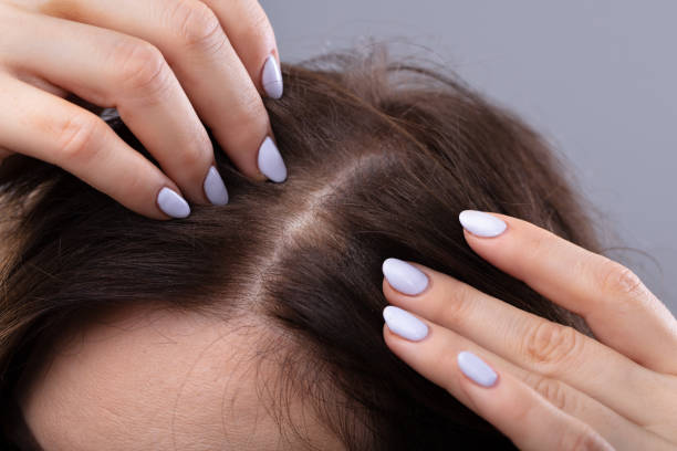 The Link Between Hair Fall and Scalp Health The Link Between Hair Fall and Scalp Health