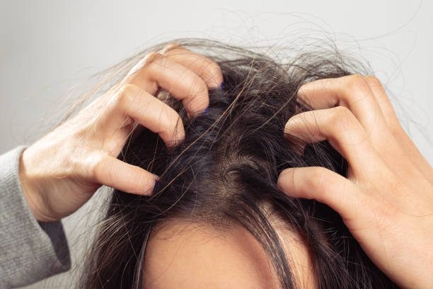 The Link Between Hair Fall and Scalp Health The Link Between Hair Fall and Scalp Health