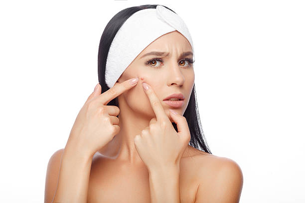 How To Remove Pimples Overnight: 8 Top Tips 