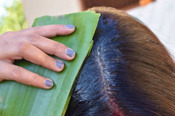 FAQs about Benefits of Aloe Vera for hair