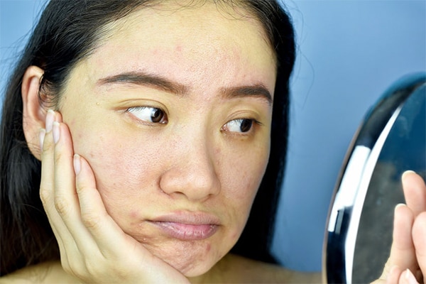 Causes of Pale Skin and How to Treat It According to An Expert