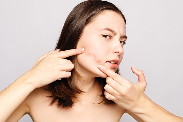 skin expert dr rashmi shetty answers acne queries skin expert dr rashmi shetty answers acne queries
