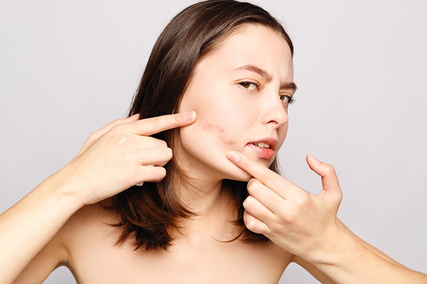 skin expert dr rashmi shetty answers acne queries skin expert dr rashmi shetty answers acne queries